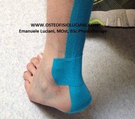 Achilles tendinopathy (or Achilles 